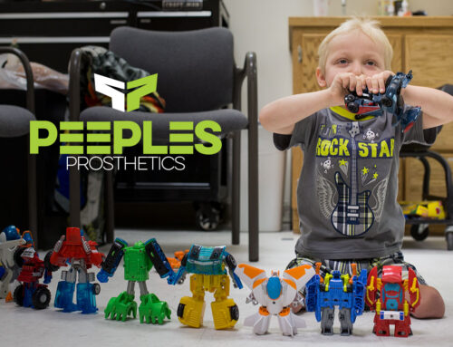 Bear – Wichita’s Own Transformer | Peeples Prosthetics, Wichita, KS